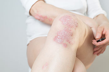 Aloe Helps Hydrate Dry Skin and Rashes