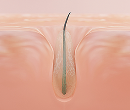 Clogged Pore Close Up